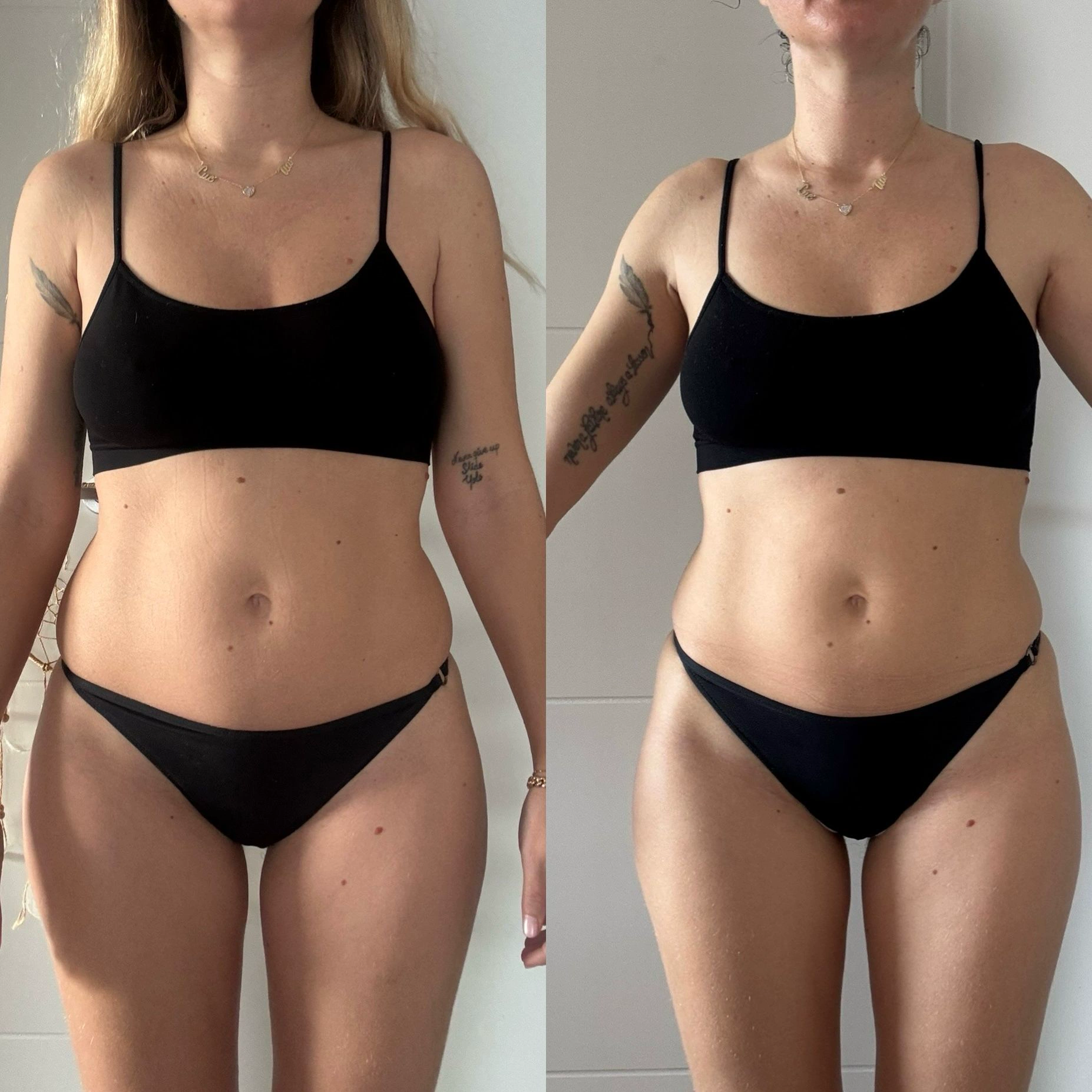 Transformation Alisson