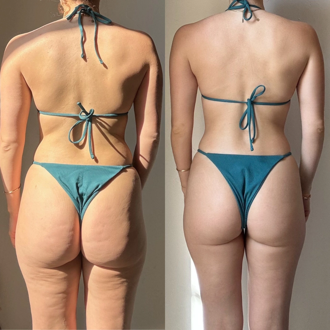 Transformation Eva — vue dos