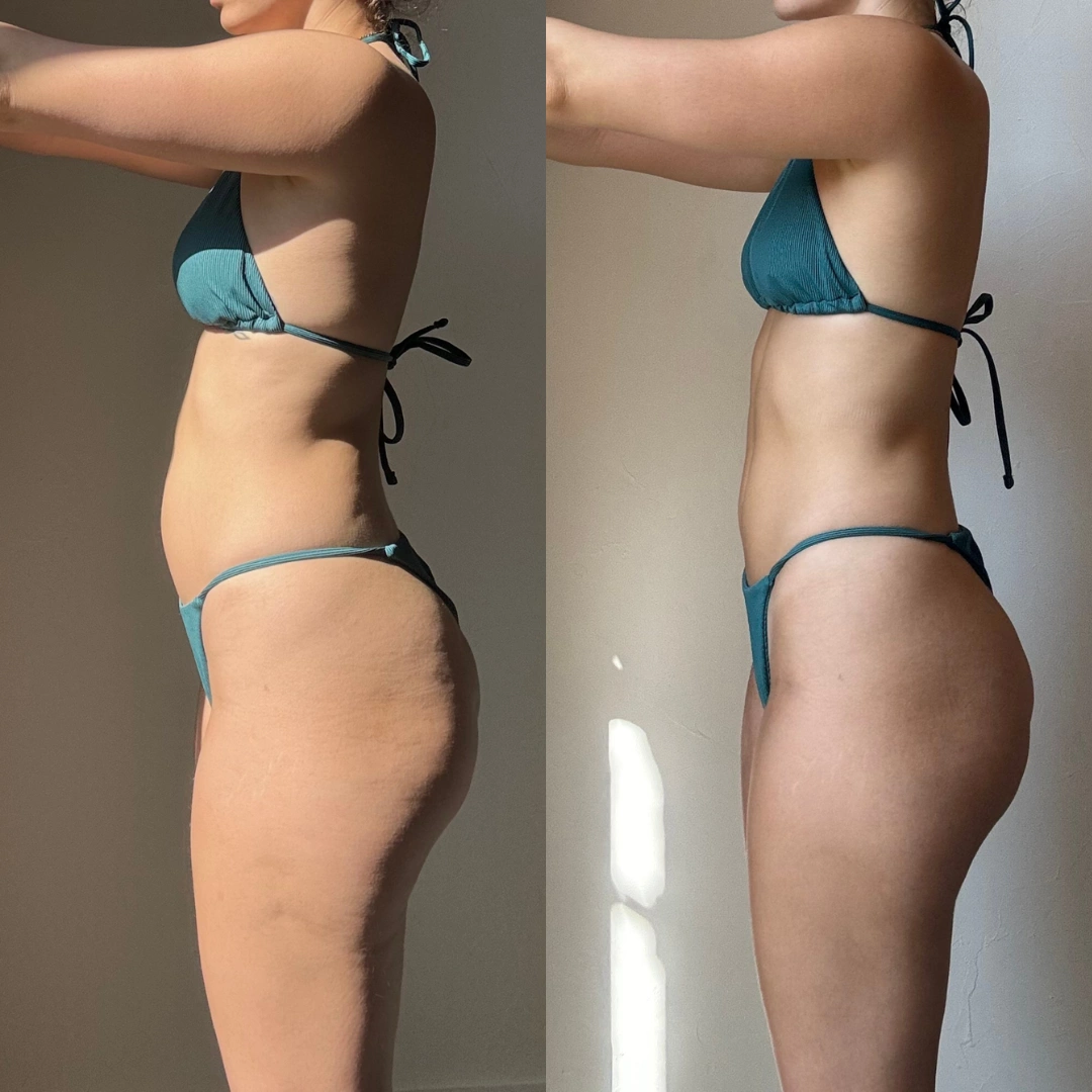 Transformation Eva — vue profil